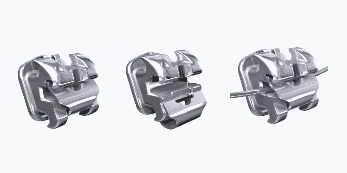 Self-ligating braces