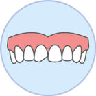 Chipped teeth