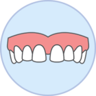 Gaps teeth