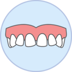 Uneven teeth