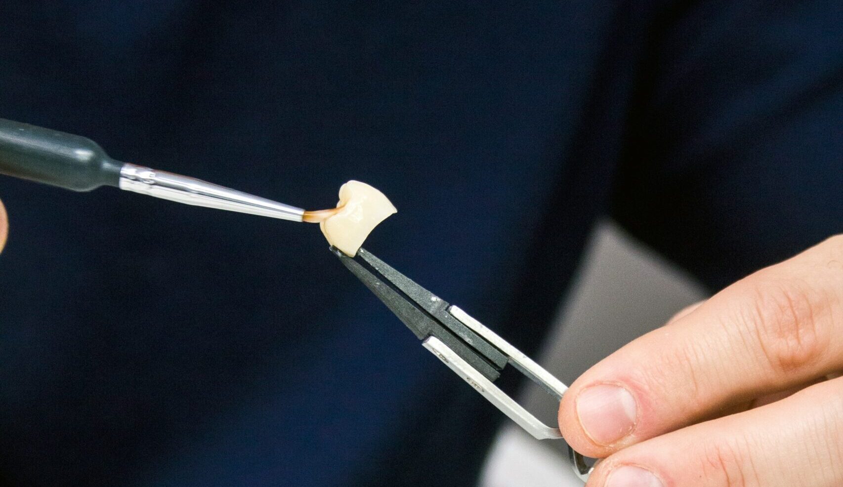 Comparison of teeth before and after dental crowns, showing improved appearance and alignment.