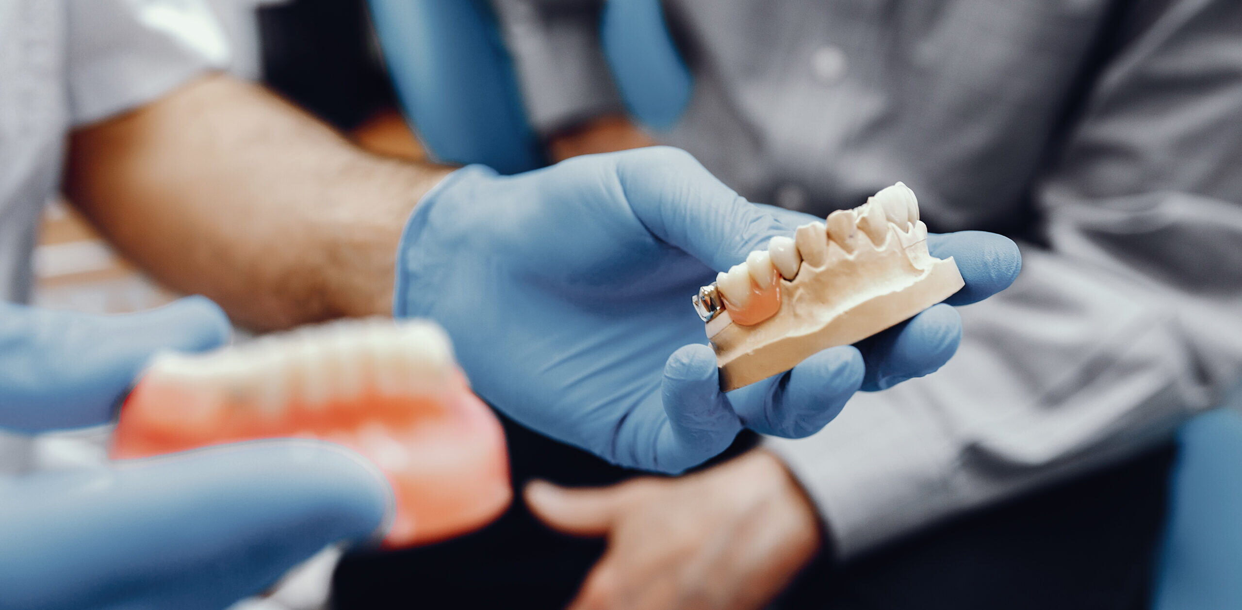 A side-by-side comparison showing the transformation from a gap to a fully restored smile with dental implants.