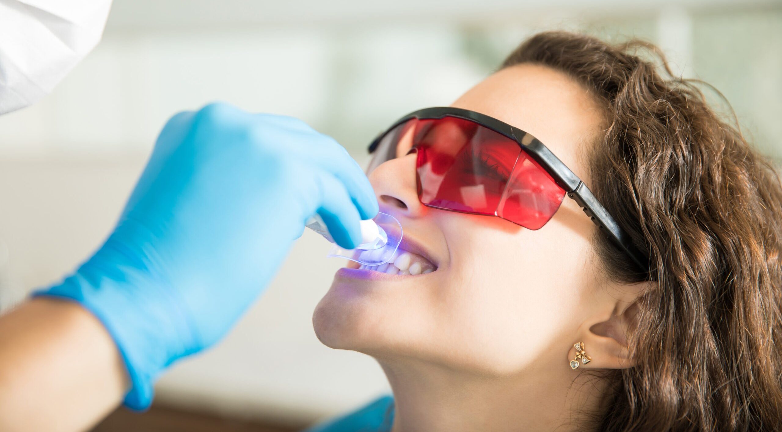 A home teeth whitening kit with trays, whitening gel, and instructions